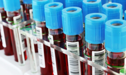 Fibrinogen Blood Test: Functions And Results