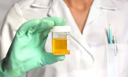 Leukocytes In The Urine: What Do They Mean?
