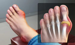 9 Diseases That Cause Pain In The Big Toe