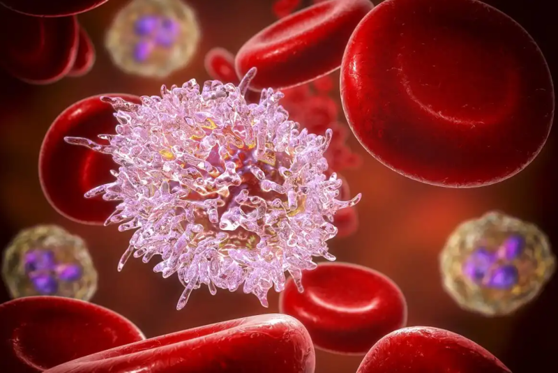 What are the leading causes of high lymphocytes?