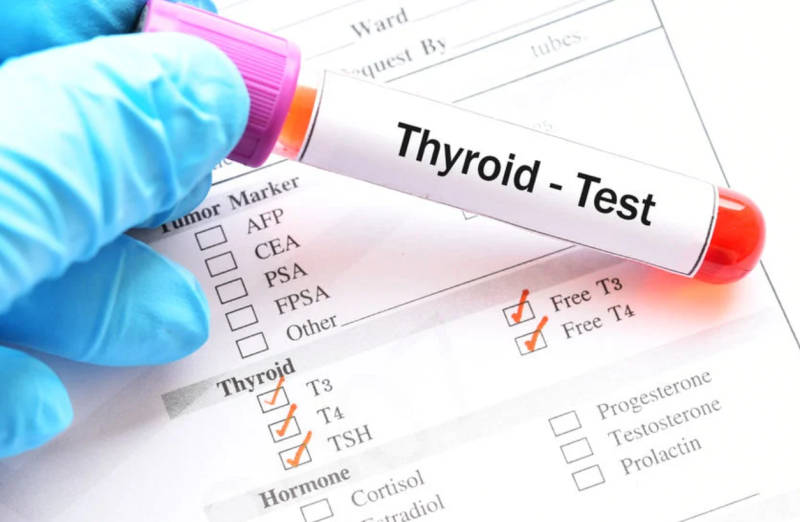 Low TSH: What Are The Causes?