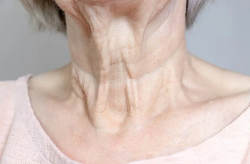 5 exercises to have a defined jaw