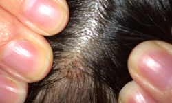 6 Possible Causes Of A Lump On The Head