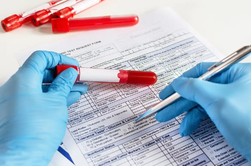 Values ​​indicating low blood neutrophil count