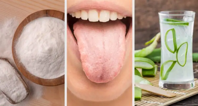 You Can Get Rid Of White Tongue With These 8 Natural Remedies