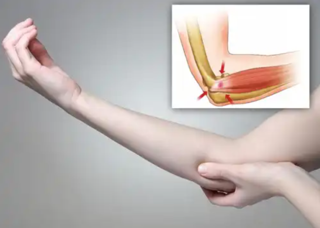 Soothe Tennis Elbow With 5 Natural Remedies