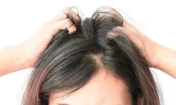 Does Your Scalp Itch? 7 Natural Remedies To Calm It Down