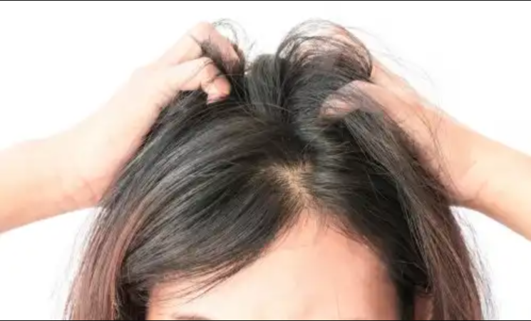 Does Your Scalp Itch? 7 Natural Remedies To Calm It Down